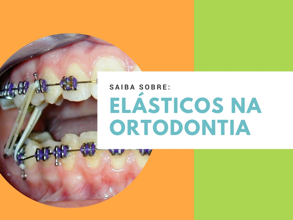 elasticos ortodontia